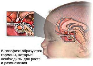 Основні симптоми різних видів пухлин головного мозку