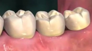 Будова зубів людини