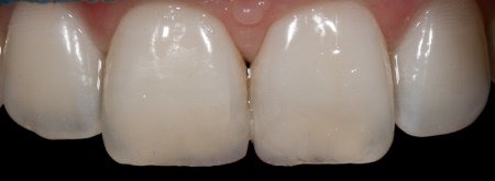 Будова зубів людини