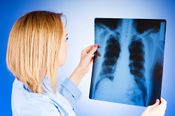 Методи діагностики захворювання туберкульозу