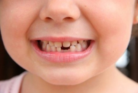 Коли випадають молочні зуби?