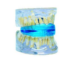 Що таке трейнер для зубів?