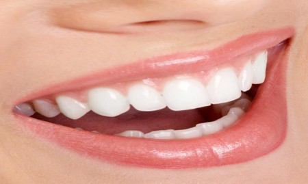 Здорові зуби   білосніжна посмішка