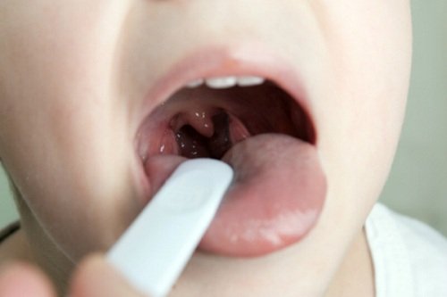 Чим небезпечні хвороби горла, основні причини їх виникнення?