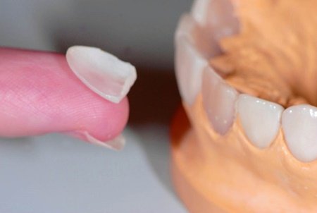 Що робити, якщо відколовся шматочок зуба