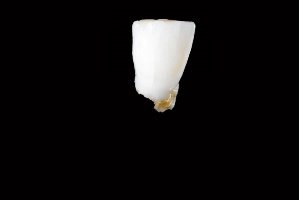 Коли випадають молочні зуби?