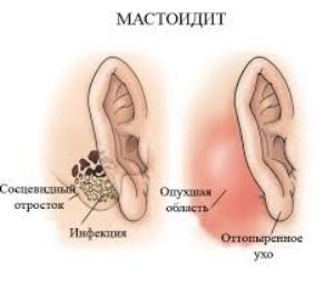 Які хвороби вуха у людини відомі медицині