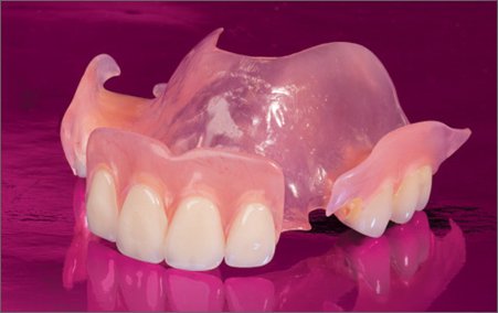 Вартість нейлонових зубних протезів