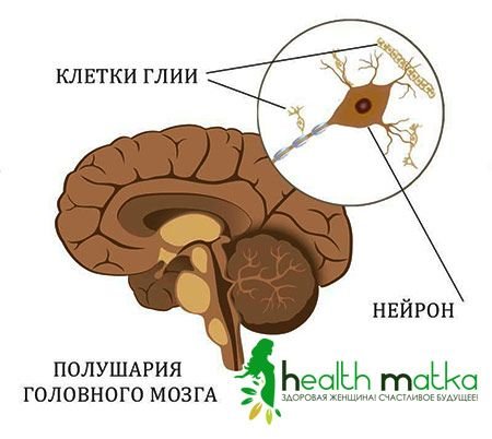 Глиобластома головного мозку   Саме підступне захворювання