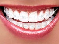 Скільки зубів у людини всього
