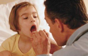 Лікування герпесной та інших форм ангіни у дітей за Комаровським