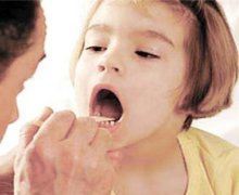 Лікування дифтерії народними засобами у дітей і дорослих