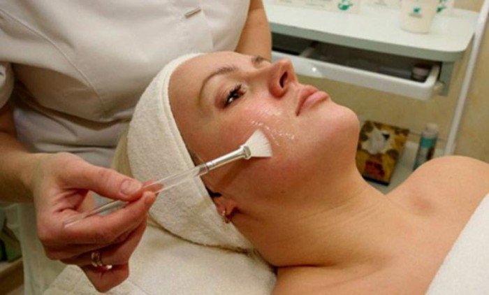 Хімічний пилинг ТСА — ефективний спосіб освіжити і омолодити шкіру