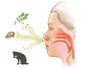 Опис алергічного фарингіту і його лікування