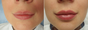 Татуаж губ: види, фото до і після, відгуки