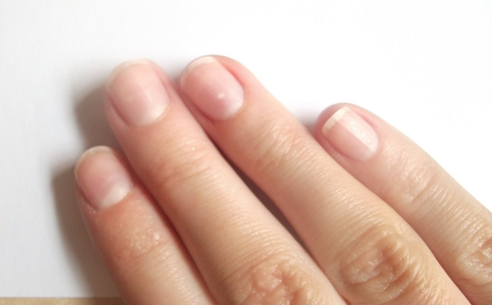 Про що говорять нігті на пальцях рук?