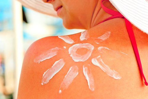 Обгоріла шкіра на сонці: що робити? Допомога при сонячних опіках