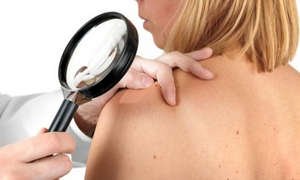 Що таке базаліома шкіри, способи лікування і діагностики