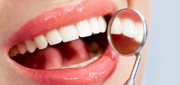 Лікування карієсу в домашніх умовах: допоможіть своїм зубам народними засобами