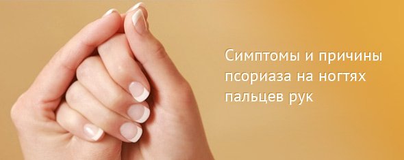 Лікування псоріазу нігтів пальців рук — ефективні засоби