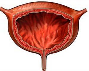 Печіння в сечовипускальному каналі — причини і методи лікування