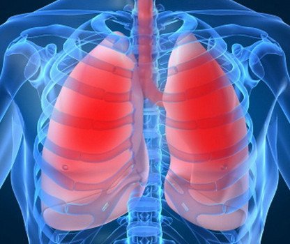 Симптоми пневмонії легенів