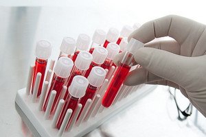 Що можуть означати показання підвищених моноцитів в крові у дорослої людини?