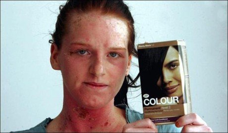 Чи можлива повторна алергія на фарбу для волосся