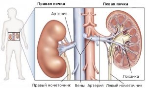 Лікування гідронефрозу народними засобами