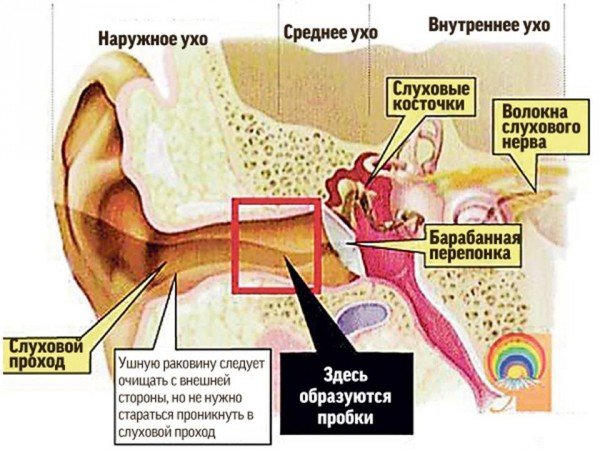 Як видалити сірчану пробку з вуха в домашніх умовах