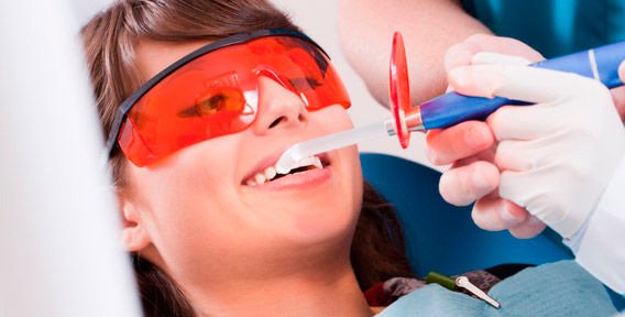 Як можна відбілити зуби, і всі способи безпечні?