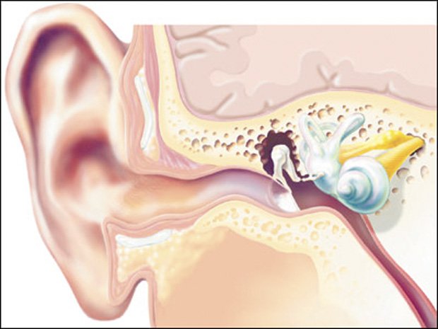 Зморшки на мочках вух – що вони віщують?