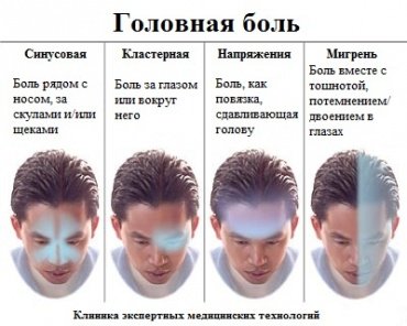 Головний біль