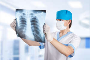 Навіщо потрібна рентгетограмма легенів, у чому її відмінність від флюорографії