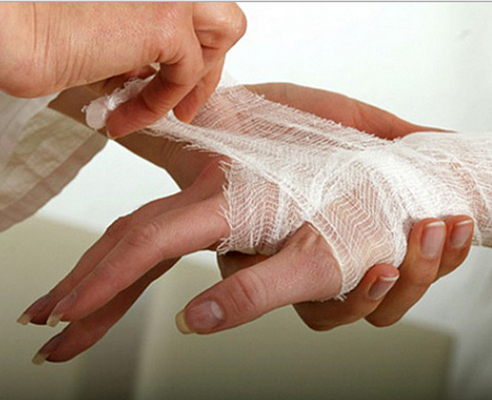 Як позбутися від шрамів після опіку: методи лікування опікових рубців