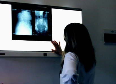 Як робиться рентген шлунка з барієм?