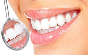 Як можна відбілити зуби в домашніх умовах