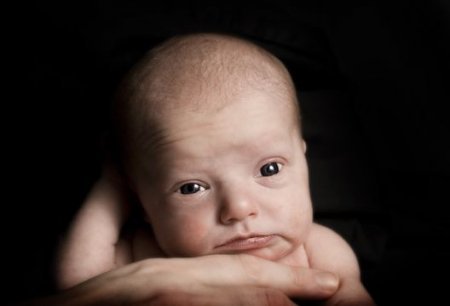 Непрохідність слізного каналу у новонароджених. Діагноз і лікування