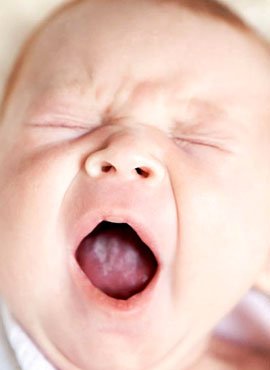 Молочниця у немовляти – симптоми і лікування недуги