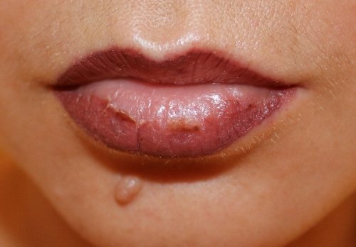 Правила догляду після татуажу губ