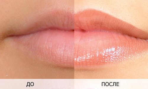 Татуаж губ з розтушовуванням – одна з найбільш затребуваних косметичних процедур