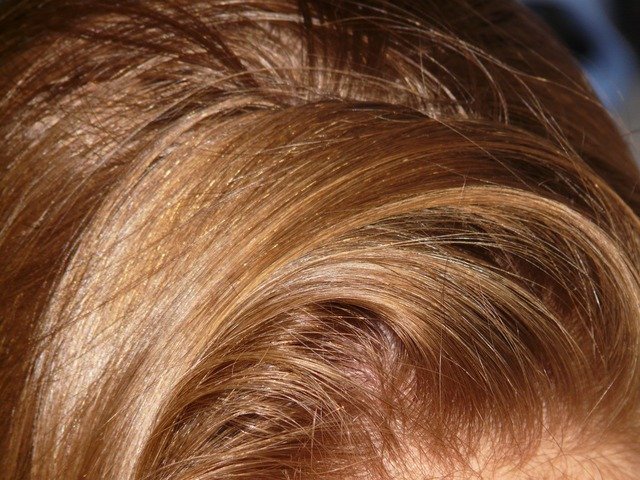 Маска з димексидом для волосся як засіб лікування в домашніх умовах