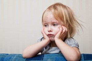 Набряк Квінке у дітей: можливі причини, симптоми, лікування