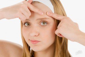 Як вилікувати прищі на обличчі – рекомендації, домашні засоби проти прищів