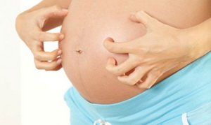 Чому свербить живіт під час вагітності