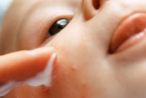 Білі прищики у дитини: можливі причини, види, засоби лікування
