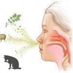 Алергічний риніт: симптоми і лікування
