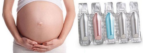 Геморой у вагітних: симптоми, ефективне лікування, профілактика