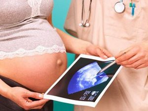 УЗД під час вагітності: коли і скільки разів можна робити