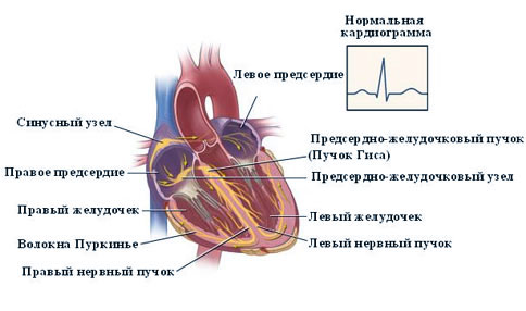 Чим небезпечна брадикардія серця?